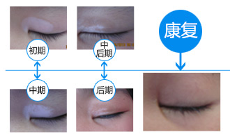 暑期白癜风专项普查